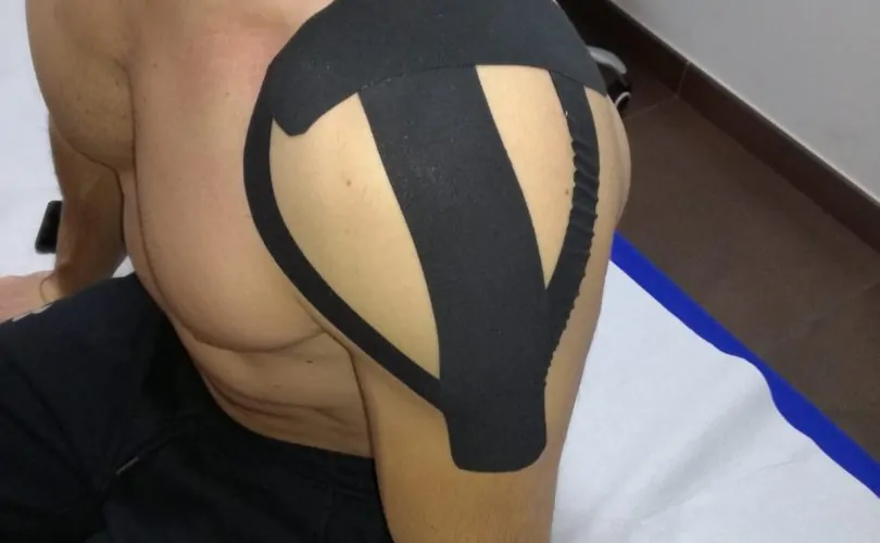 Foto terapia Taping Neuromuscolare, praticata dal Dottor Canino Francesco, proprietario dello studio di fisioterapia 39